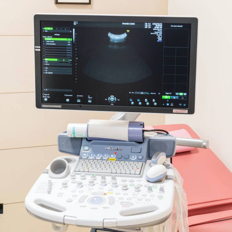 ［4D超音波検査機器］お腹の赤ちゃんを立体画像で